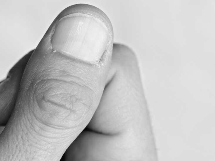 Why are fingernails hard? Yin & Yang