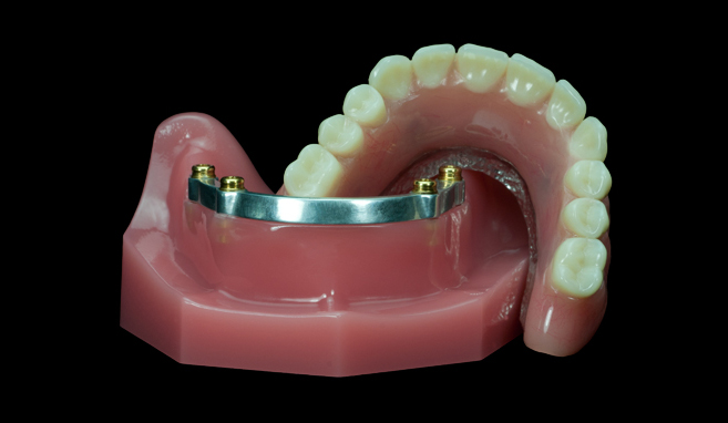 Dentures Denture Repair Wahl Dental Ceramics