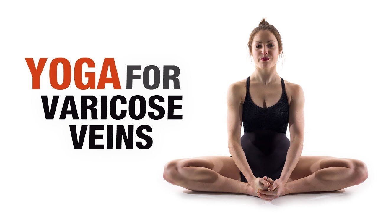 What is Varicose Veins And How To Treat It With Yoga?