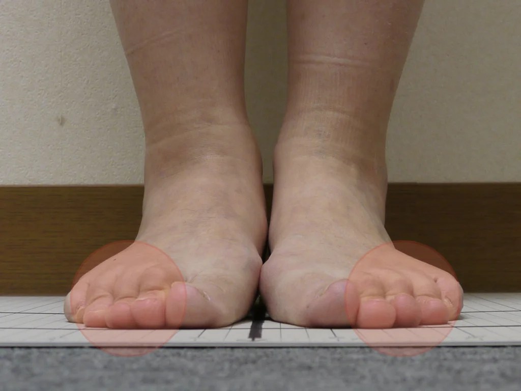 屈み 12+ Ideas For You