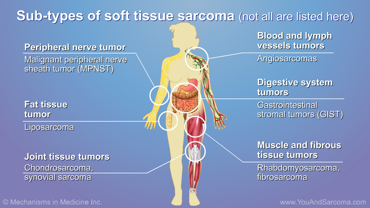 Understanding Soft Tissue