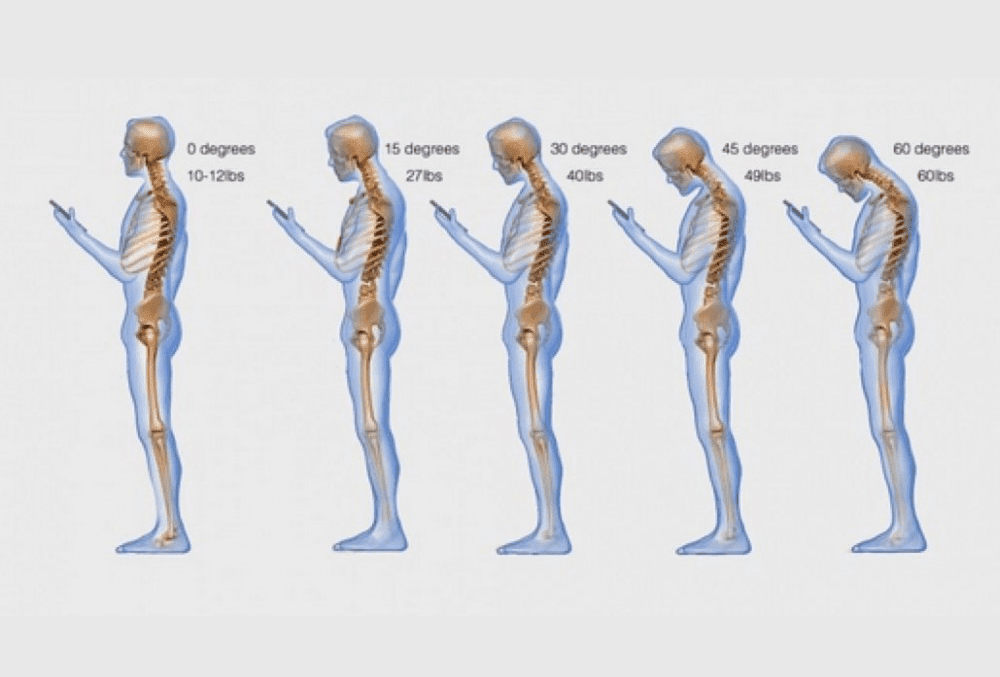 Is your smartphone a pain in the neck? Health Coach, Amber Stevens