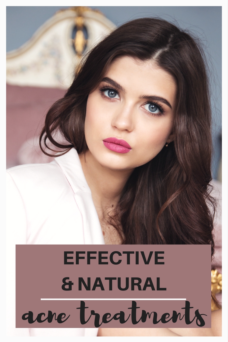 Five fantastic and effective natural acne treatments.