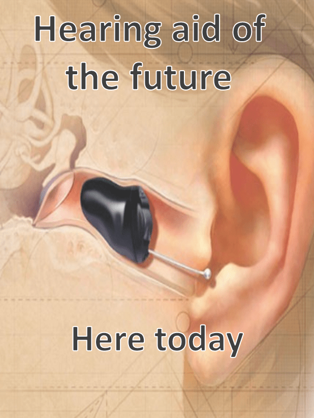 Custom Ear Molds Local Service