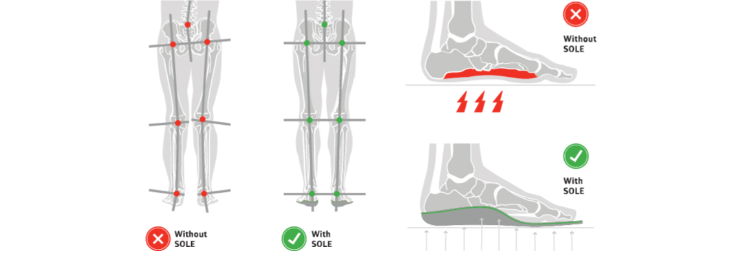 Foot health the unsung hero of wholebody happiness
