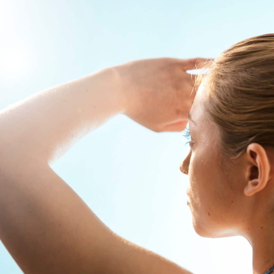 Signs Your Skin is Damaged From Too Much Sun Alpharetta GA Youthtopia Med Spa