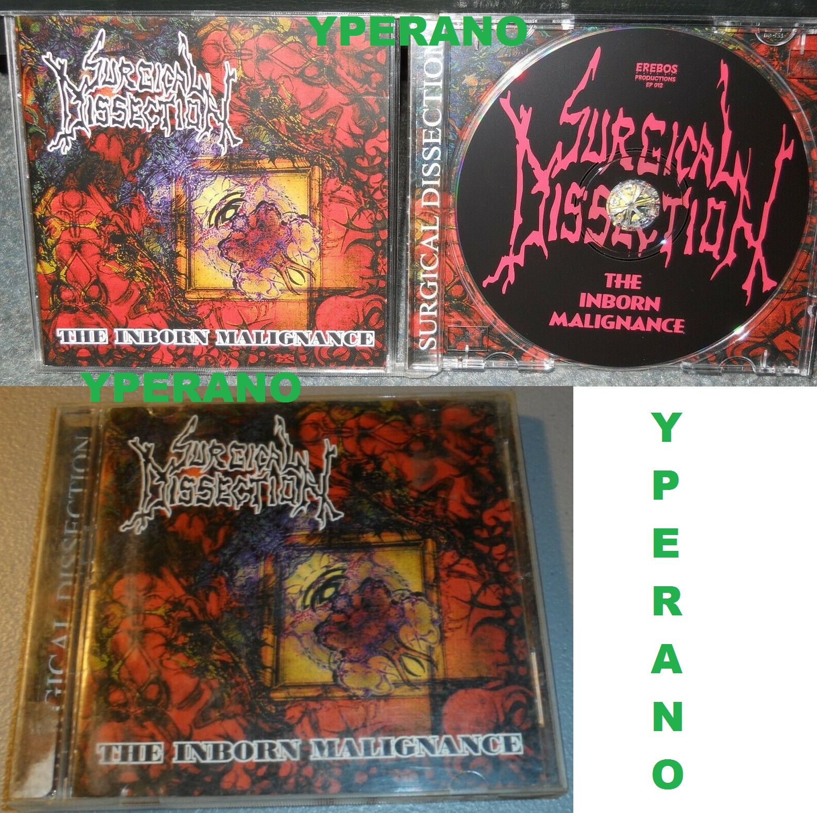 SURGICAL DISSECTION The Inborn Malignance CD. Slovakian Brutal death metal. Cannibal Corpse