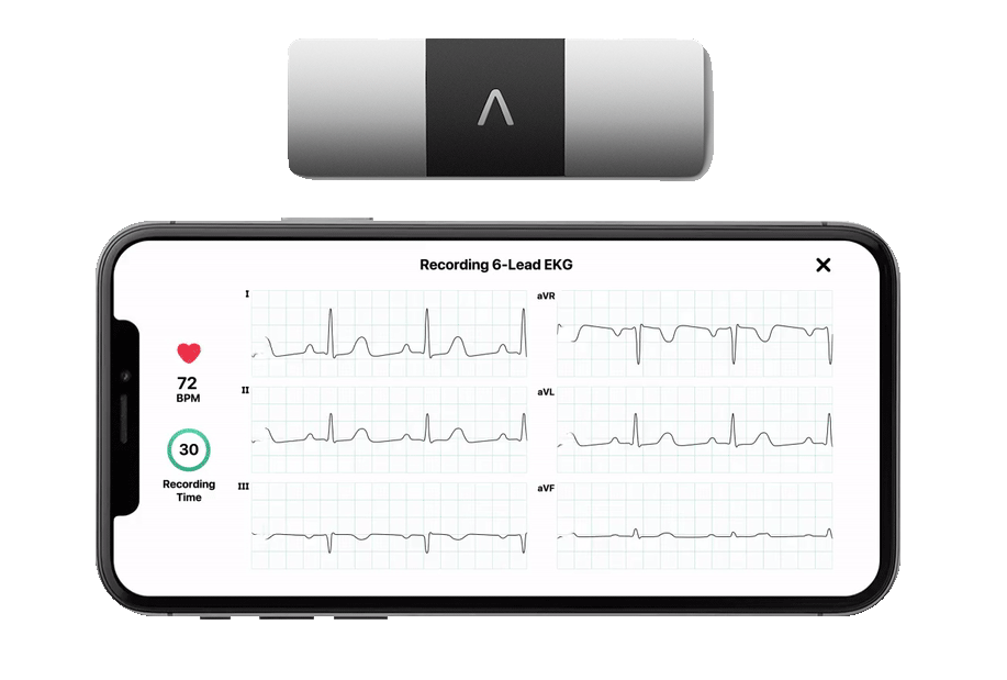 Kardia Máy đo tiện tim cao cấp cho cá nhân (FDA phê duyệt)