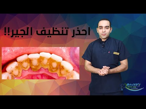 4 28 Mb تنظيف الأسنان C Download Lagu Mp3 Gratis Mp3 Dragon