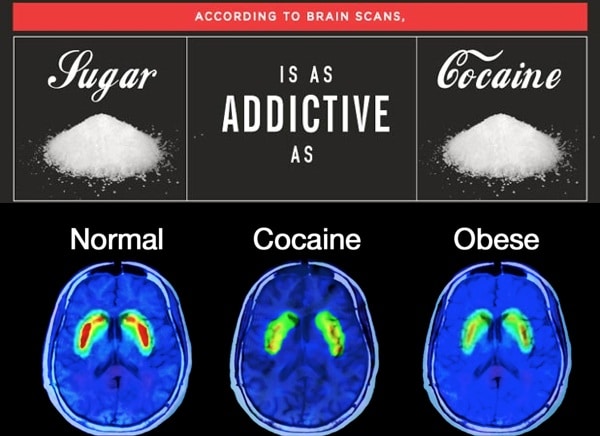 How to Stop Your Addiction to Sugar (Detox Plan Inside