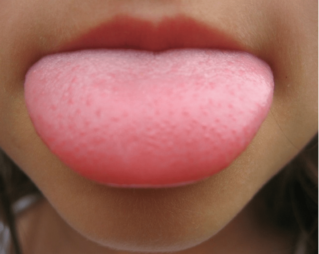 is salty taste in mouth a symptom of diabetes Salty taste in mouth why