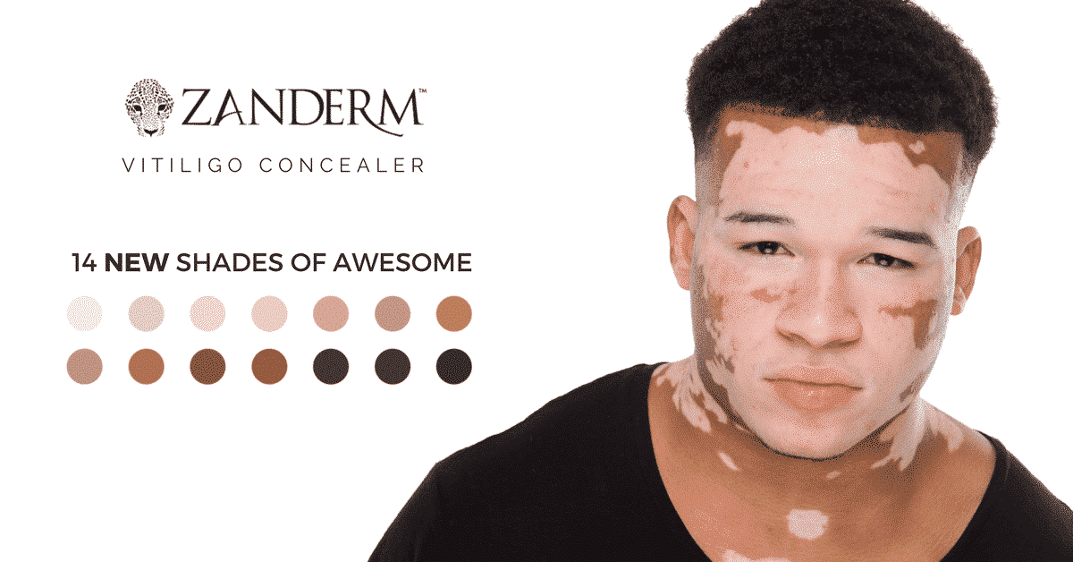 Vitiligo Makeup Camouflage & Concealer • Vitiligo Cover • Zanderm­®