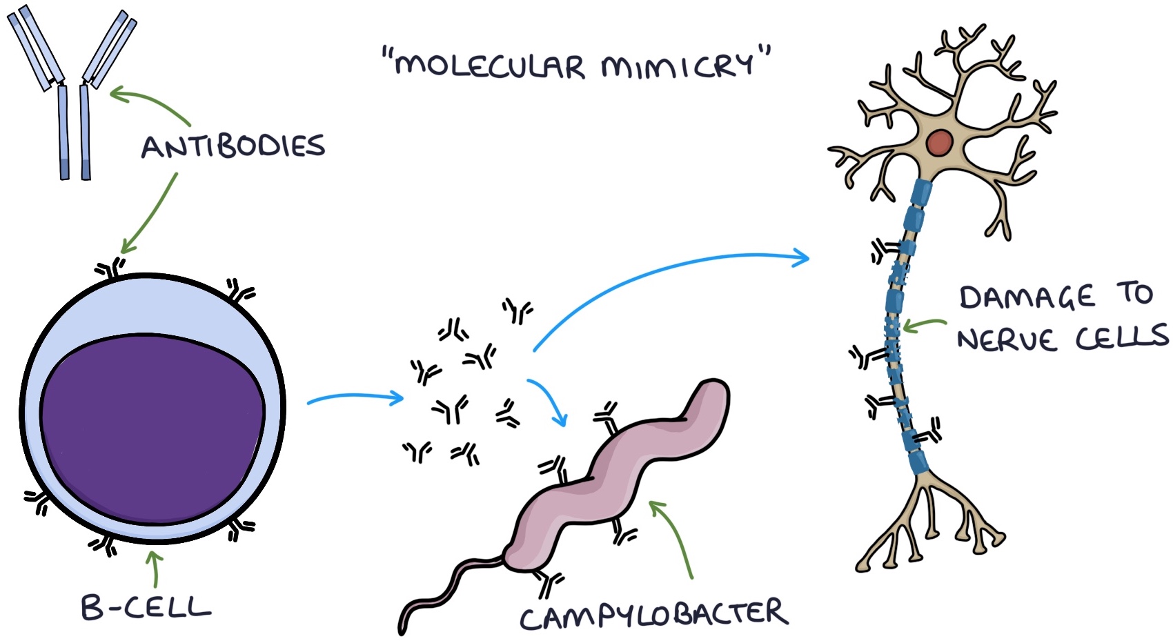 GuillainBarré Syndrome Zero To Finals