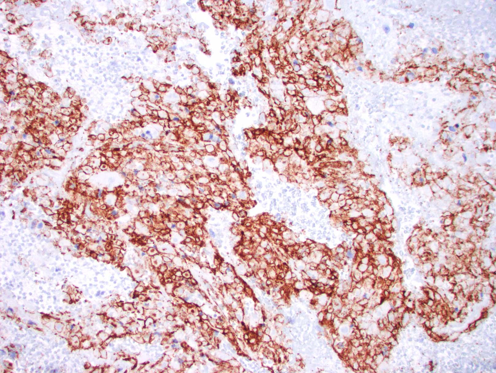 CD31 Monoclonal Antibody IVD Antibody for IHC Zeta Corporation