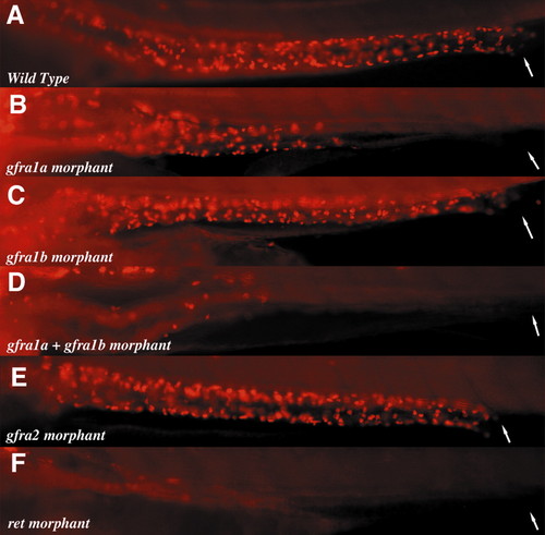 Anti Hu Antibody Ldwtanka