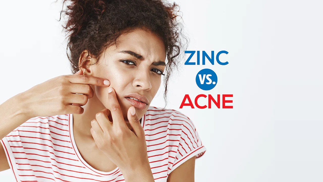Zinc and Acne How Does It Work? Zinplex South Africa