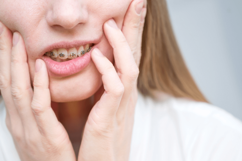How to Protect Your Mouth From Broken Braces