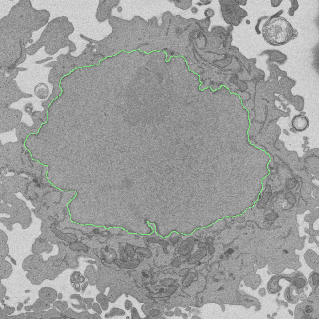 November 2020 Zooniverse