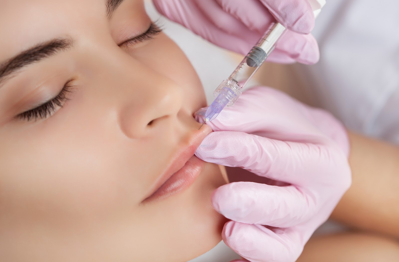 Botox Lip Flip What Is It & How Does It Work? Calgary