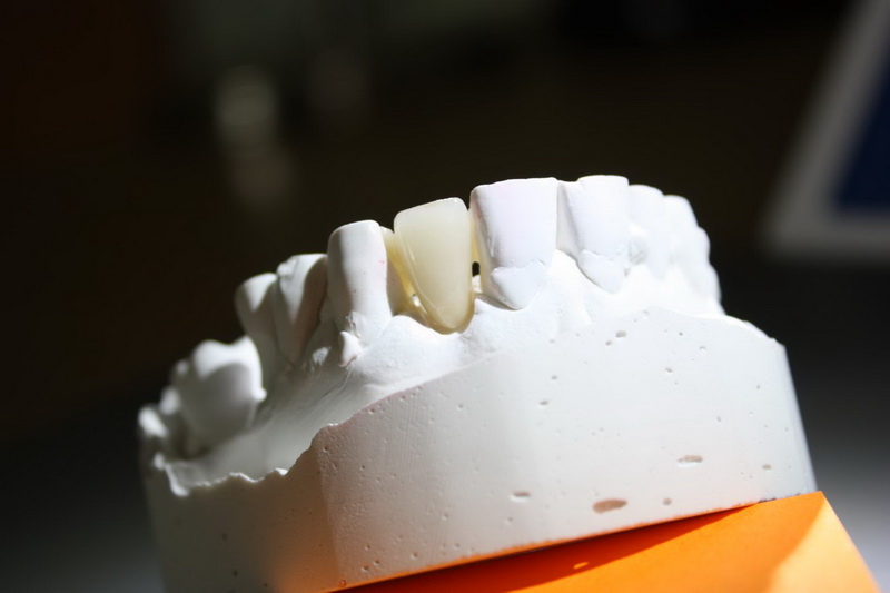 Zych Ceramics Dental Laboratory